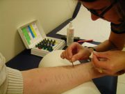 Allergie: chi le conosce, le evita
