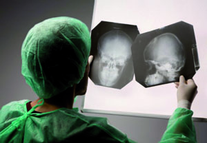 Epilessia, basta pregiudizi