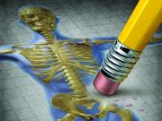 Quei “nonni” riminesi dalle ossa troppo fragili