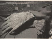 Le mani sante di Amato Ronconi