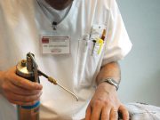 Melanoma, riminesi più a rischio