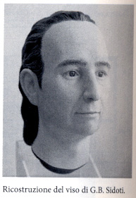 ricostruzione-viso-sidoti