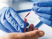 Donini: “Sierologici per tutti”