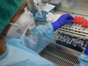 Coronavirus, Rimini 106 casi di positività, 55 sintomatici. Meno terapie intensive