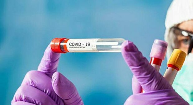 coronavirustampone70