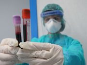 Coronavirus, 8.292 nuovi casi e 139 decessi nelle ultime 24 ore