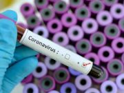 Rimini, Coronavirus: 3 nuovi casi,nessun decesso, terapie intensive in calo