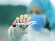 Rimini, Coronavirus: si alzano ancora i casi, 17. Però nessun decesso