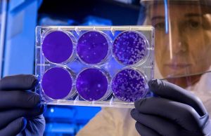 Rimini, Coronavirus: contagi in lieve aumento (67, +5), terapie intensive stabili, un decesso