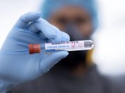 Rimini, Coronavirus: casi in aumento (33) e 1 decesso