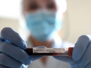 Rimini, Coronavirus: positivi in calo (262), 1 decesso