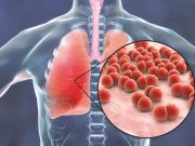 L’aria che tira (e uccide)