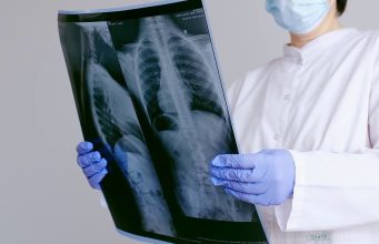 Tumori rari, i sarcomi richiedono diagnosi tempestive e alta specializzazione